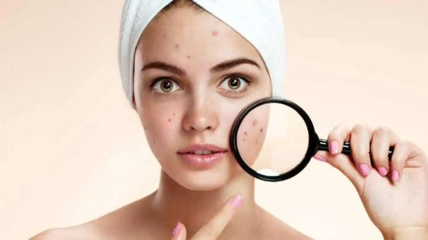How To Reduce Dark Spots?