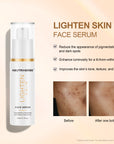 Skin Lightening Serum For Dark & Uneven Tone Skin