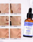 Retinol Serum Helps Defend Against Signs Of Aging