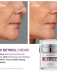كريم Neutriherbs® Pro-Retinol للتجاعيد وعلامات حب الشباب