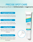 Salicylic Acid Spot Treatment for Acne & Blemishes