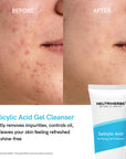 Jabón facial con ácido salicílico para pieles grasas