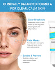 Salicylic Acid Spot Treatment for Acne & Blemishes
