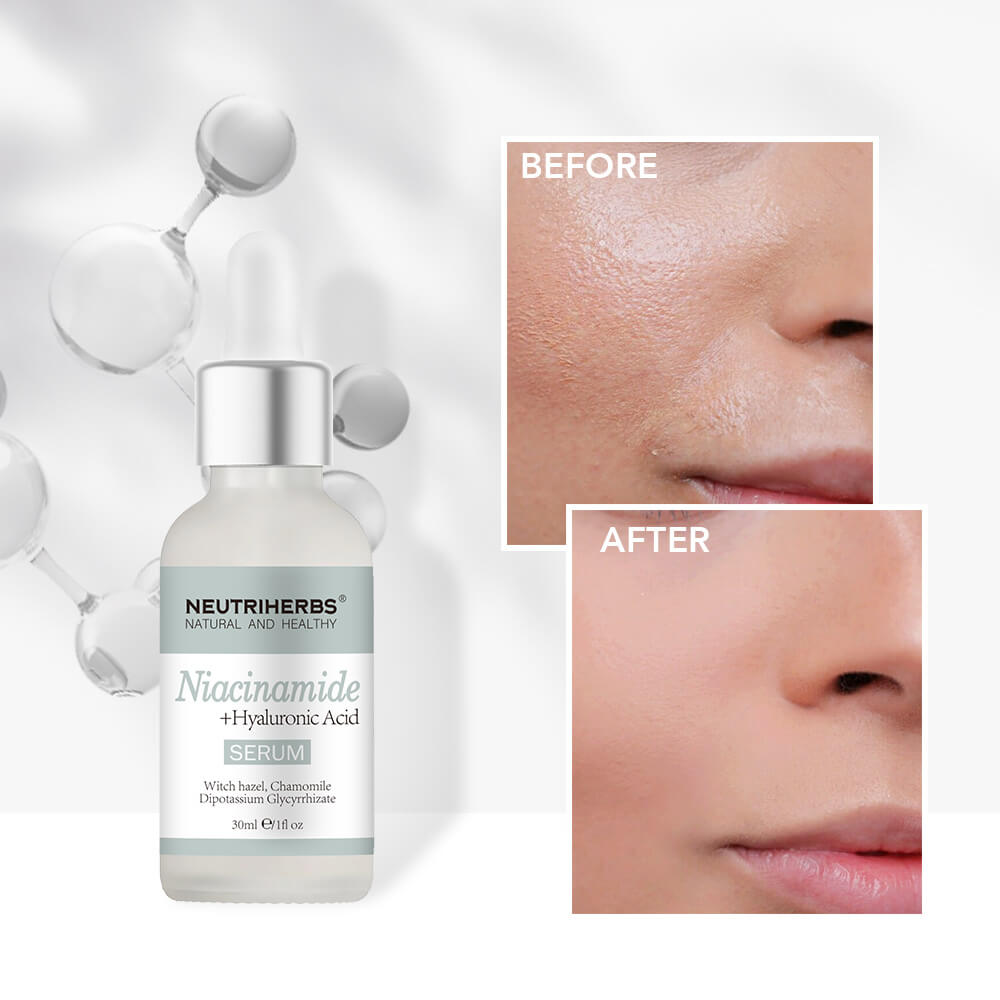 VITAMINB3 before and after use