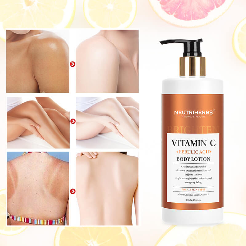 Before and after use of vitamin c body lotion