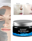 dead sea mineral mud mask-clay mud mask-dead sea facial products-dead sea skin care-best mud mask for acne-