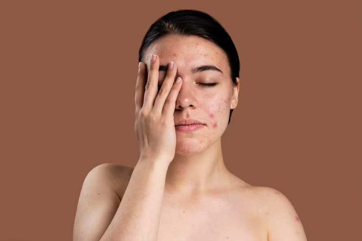 Pollution-Proof Your Skin: Neutriherbs’ Antioxidant Serums for Urban Lifestyles