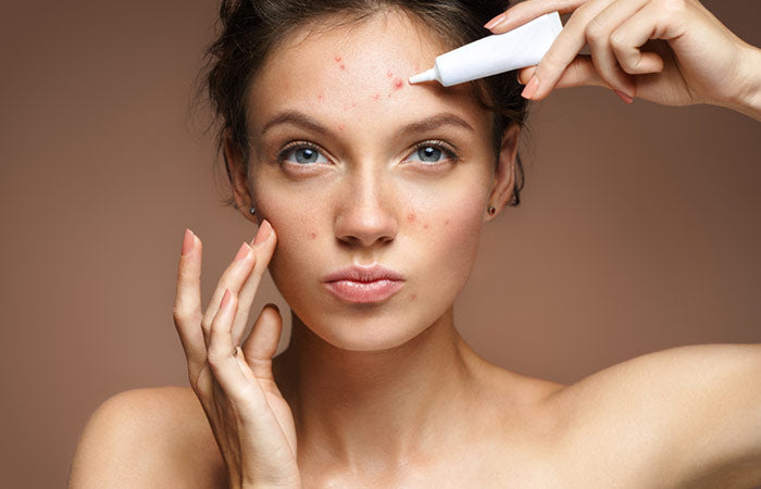 Salicylic Acid: Top Active For Oily Skin
