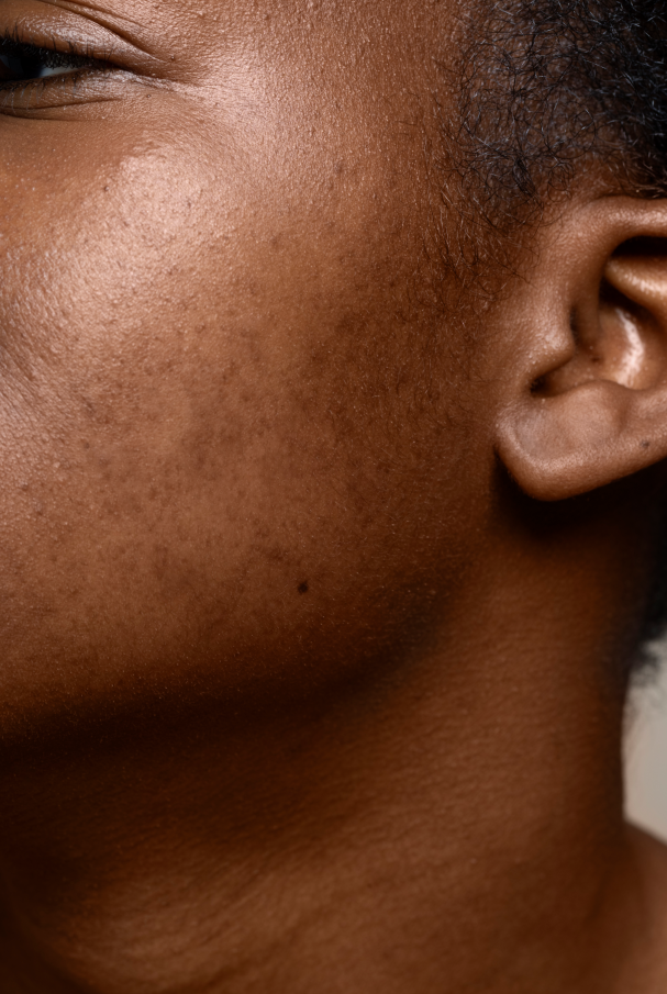 Safe Radiance for Melanin-Rich Skin: Fragrance-Free Brightening by Neutriherbs