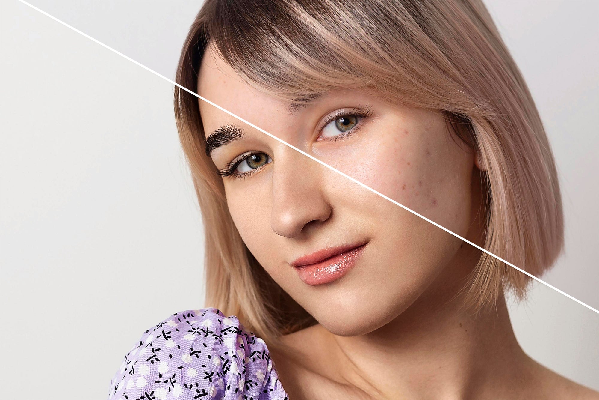 Do Pore Strips Actually Work?