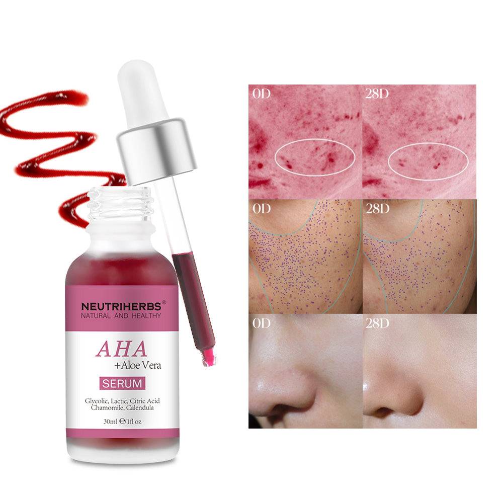 AHA Serum For Exfoliating &amp; Smoothing Skin