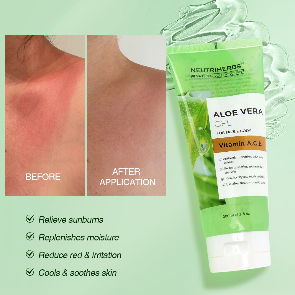 before and after use of Aloe Vera Gel