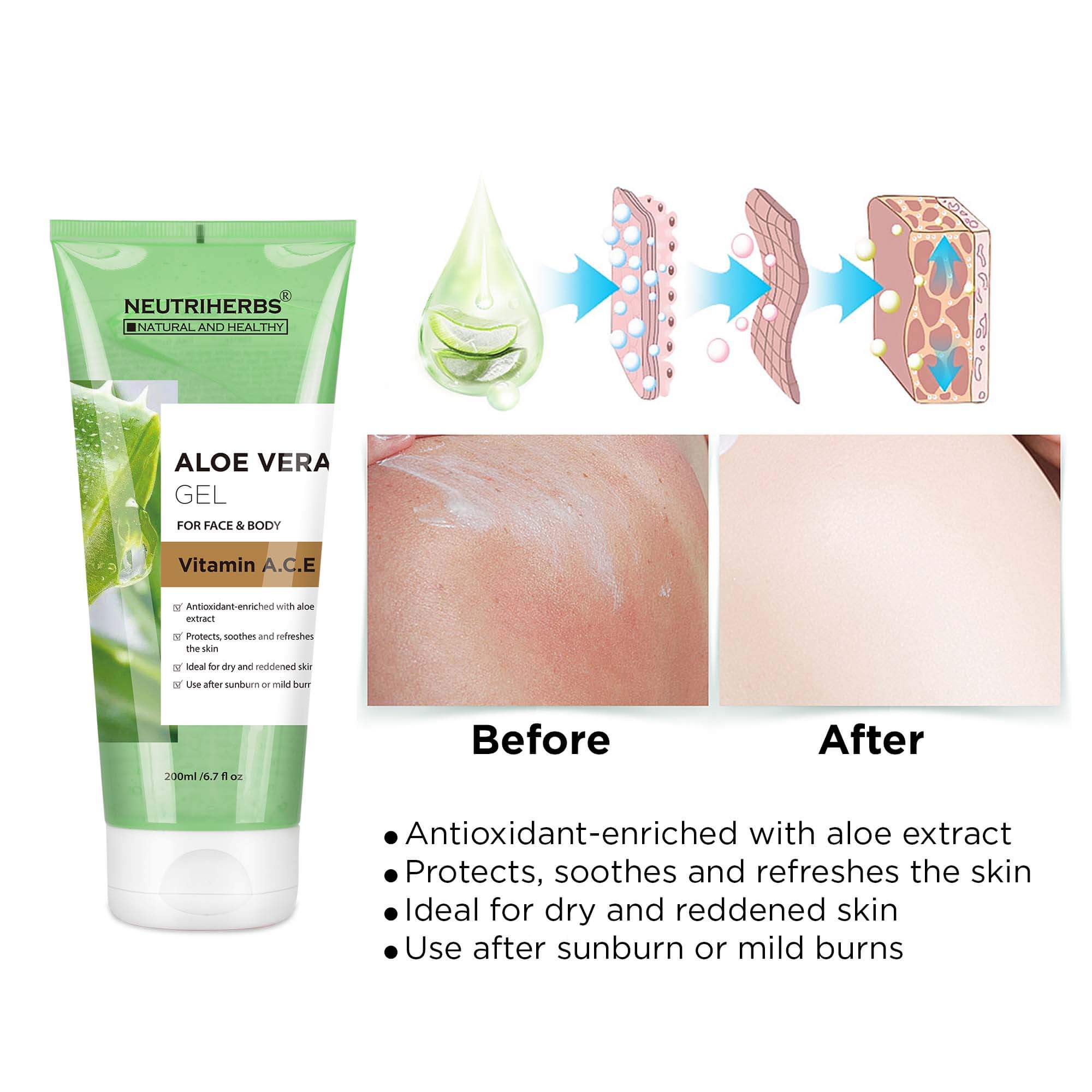 before and after use of Aloe Vera Gel