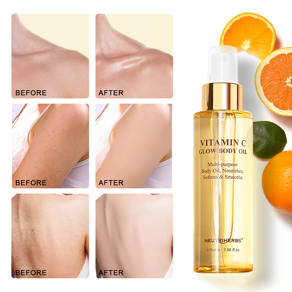 before and after about vitamin c body oil
