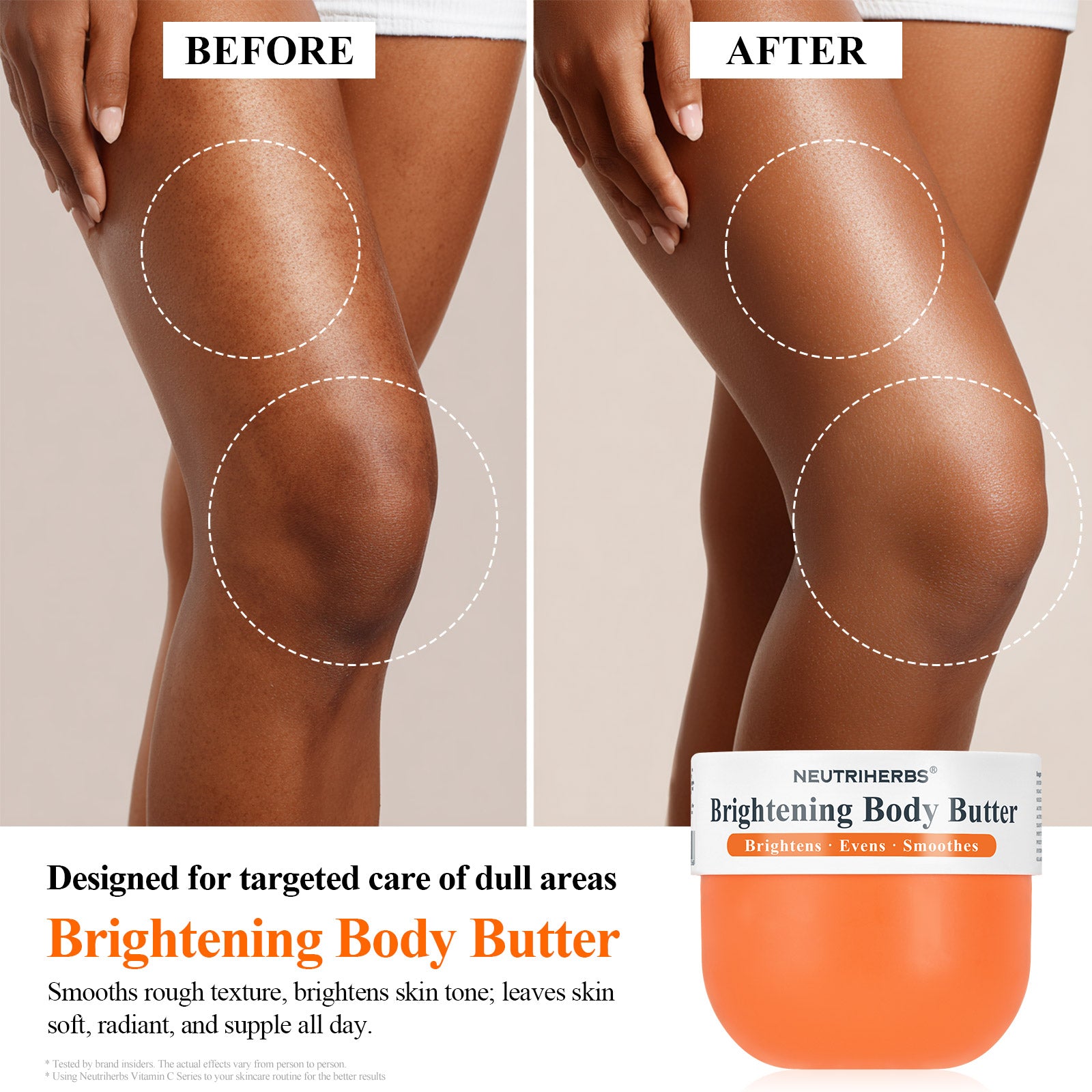 Brightening Body Butter For Dull &amp; Uneven Skin