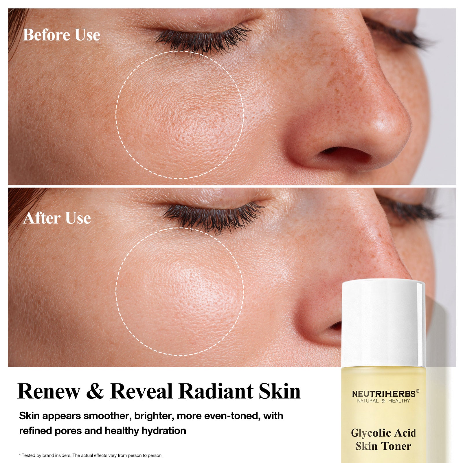 Neutriherbs Glycolic Acid Toner For Dull, Rough &amp; Uneven Skin Tone