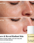 Neutriherbs Glycolic Acid Toner For Dull, Rough & Uneven Skin Tone