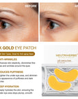 24 Karat Gold Collagen Eye Patch For Anti-Wrinkles | 5 Pairs