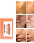 Kojic Acid Skin Brightening Soap