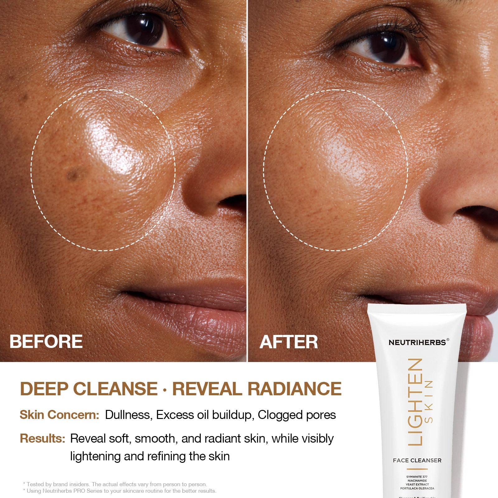 3-Step Brightening Routine Set | Cleanse, Treat & Even Skin Tone