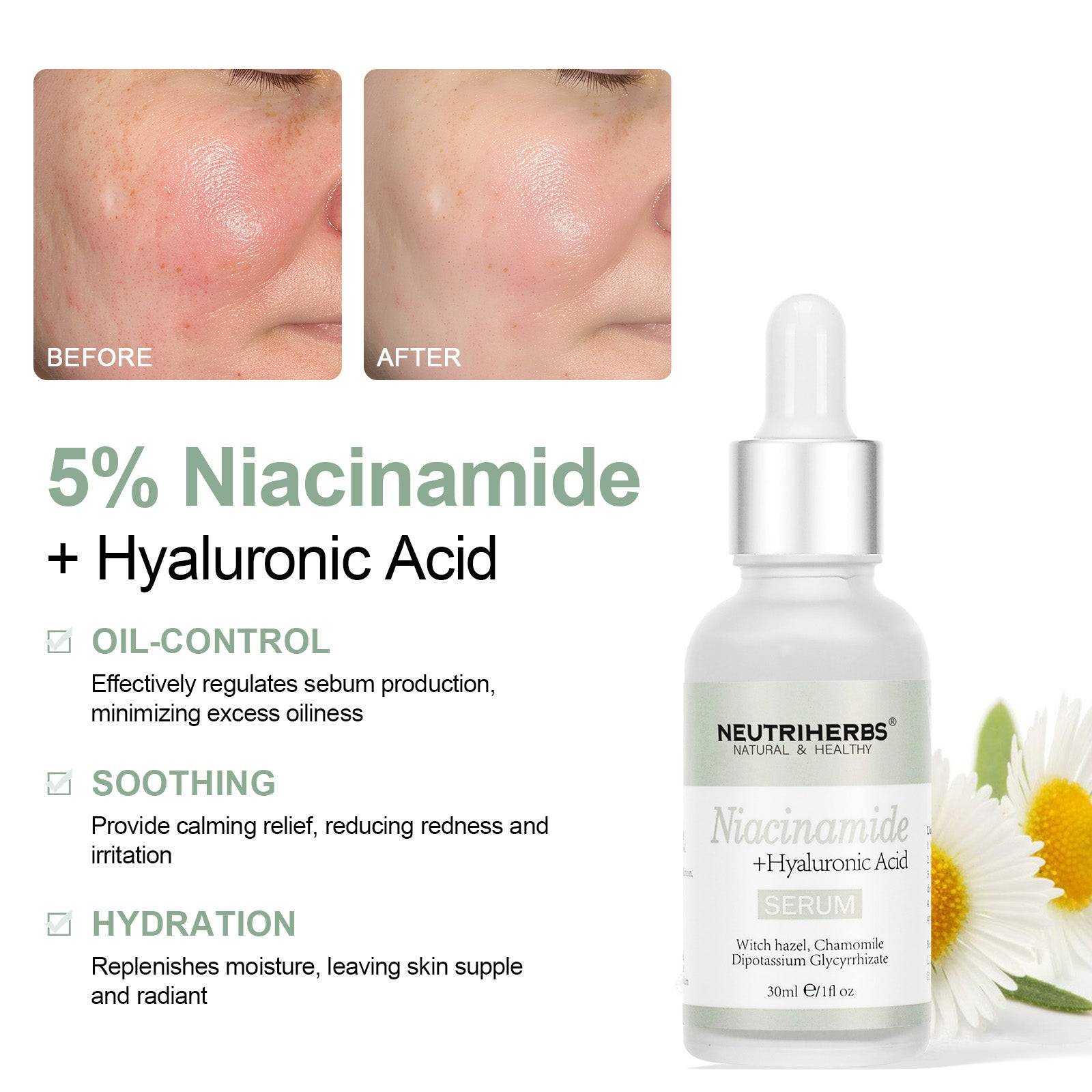 Niacinamide Serum For Brightening And Oil-control