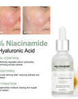 Niacinamide Serum For Brightening And Oil-control