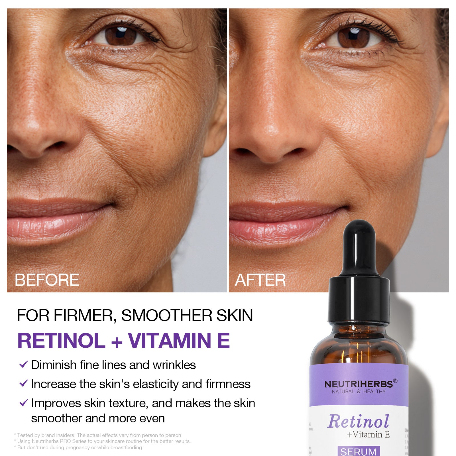 Retinol Serum Helps Defend Against Signs Of Aging