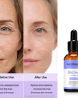 Daily Anti-Aging Skincare Routine Set
