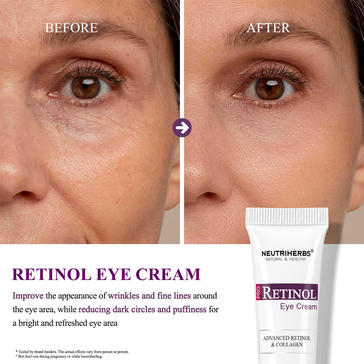 Pro Retinol Eye Cream Help Rapid Wrinkle Repair