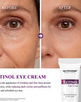 Pro Retinol Eye Cream Help Rapid Wrinkle Repair