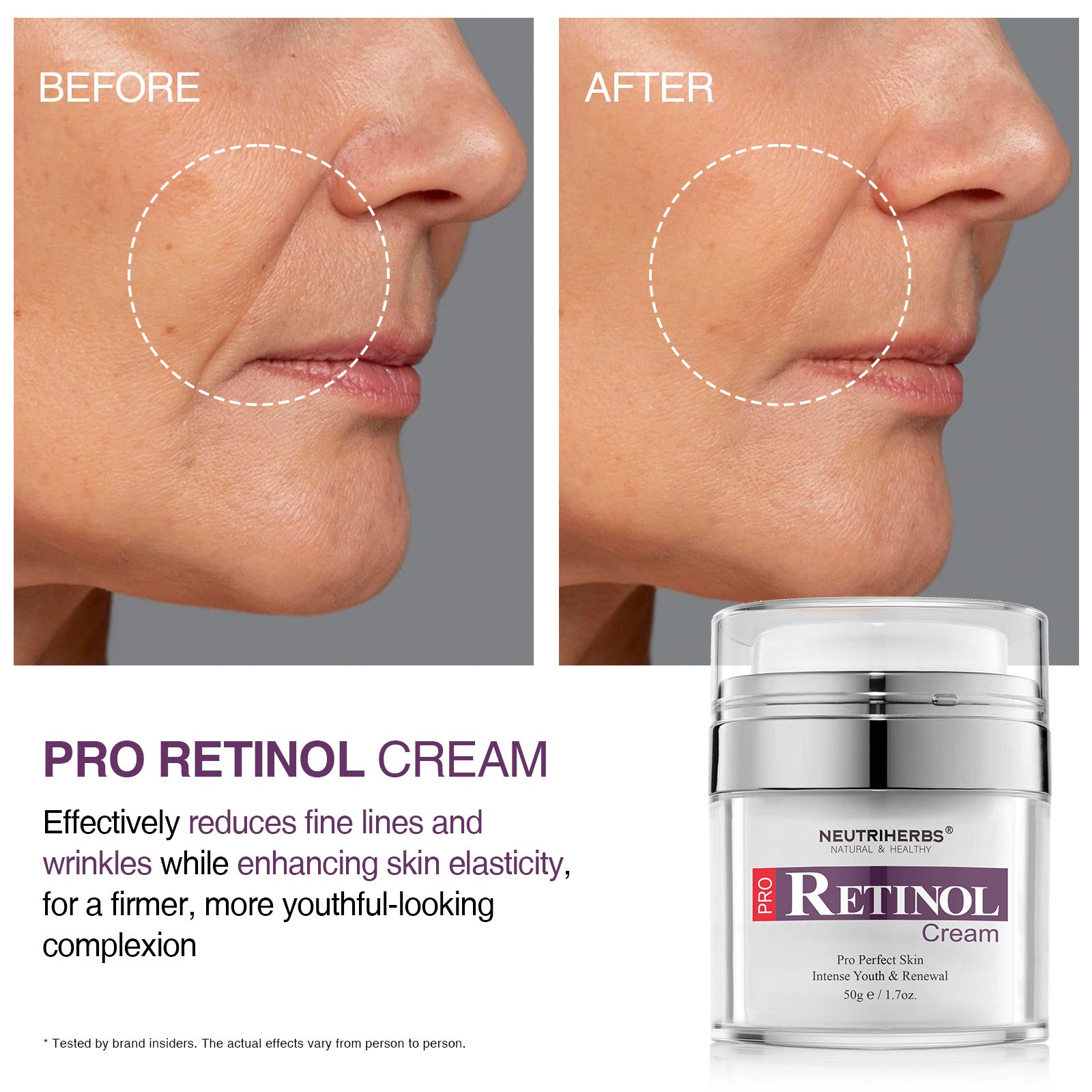 Crema Neutriherbs® Pro-Retinol para arrugas y marcas de acné