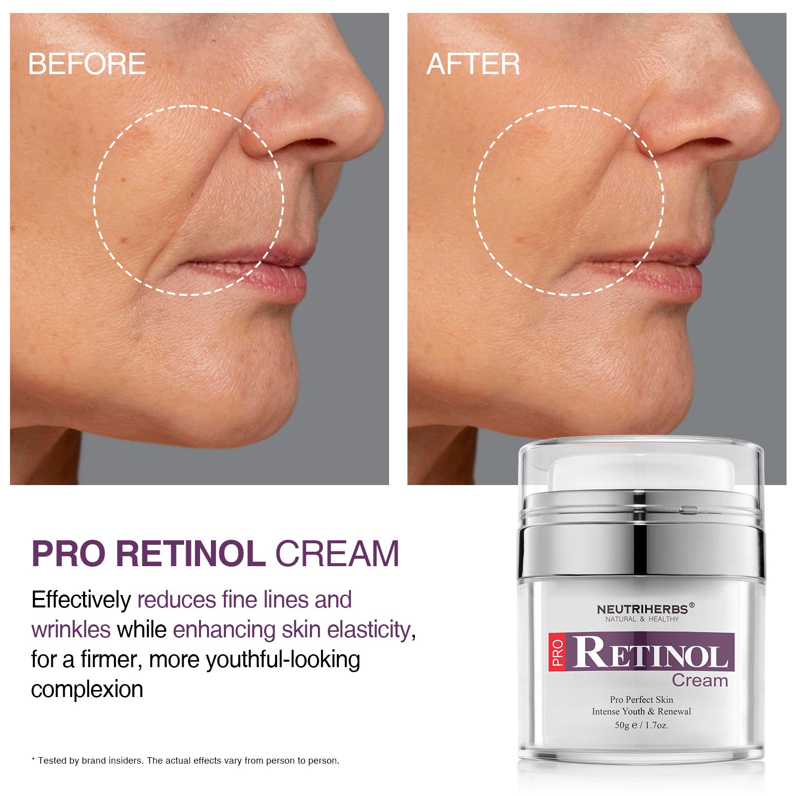 Neutriherbs® Best Duo For Aging &amp; Acne-prone Skin