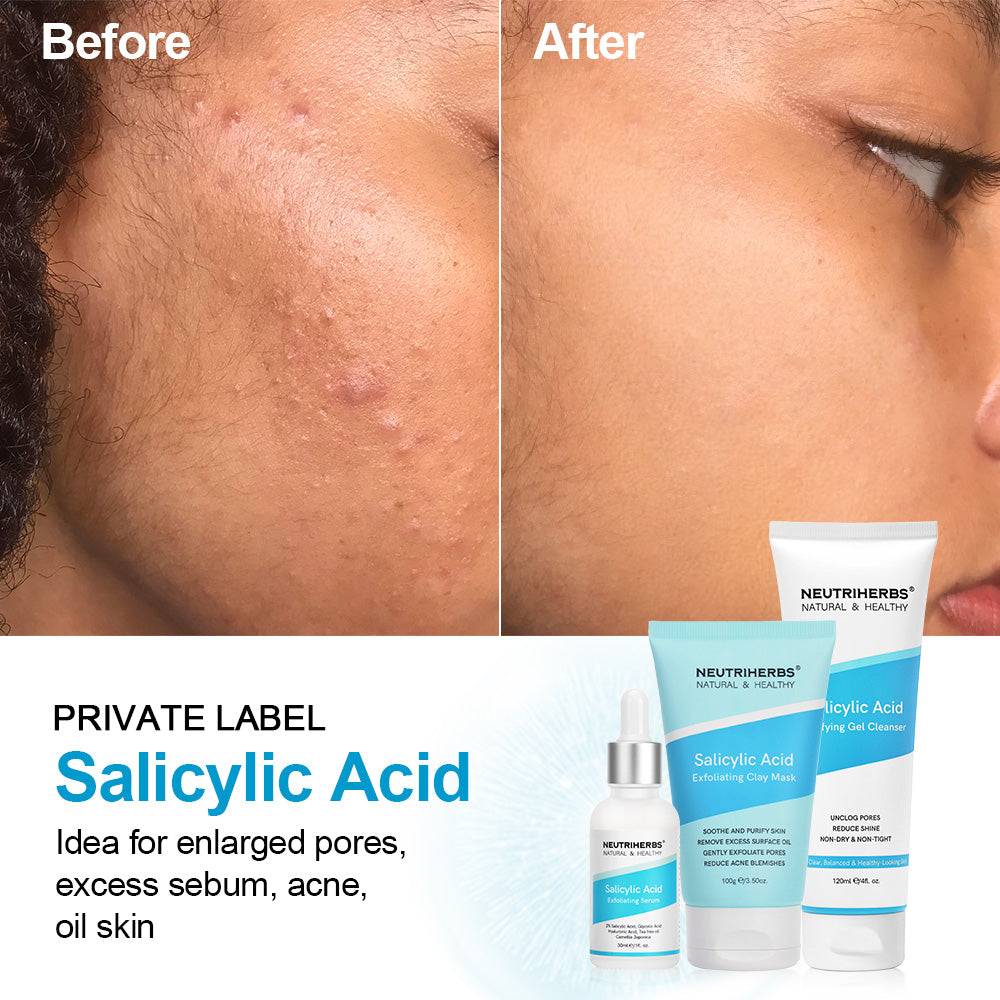 Salicylic Acid – Neutriherbs