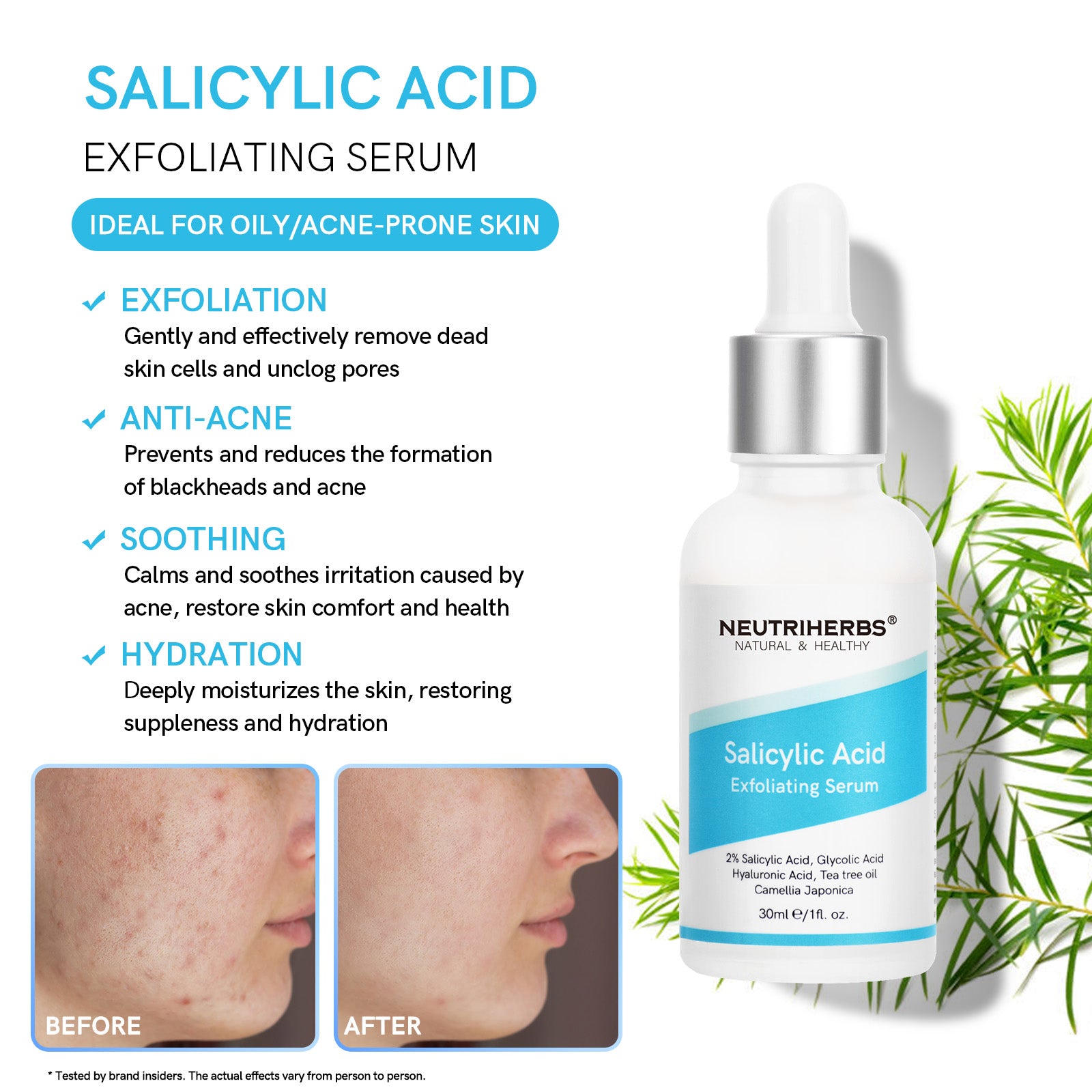 Salicylic Acid Exfoliating Serum: Ideal for oily/acne-prone skin, it gently exfoliates, prevents acne, soothes irritation, and deeply hydrates, restoring skin comfort and health.