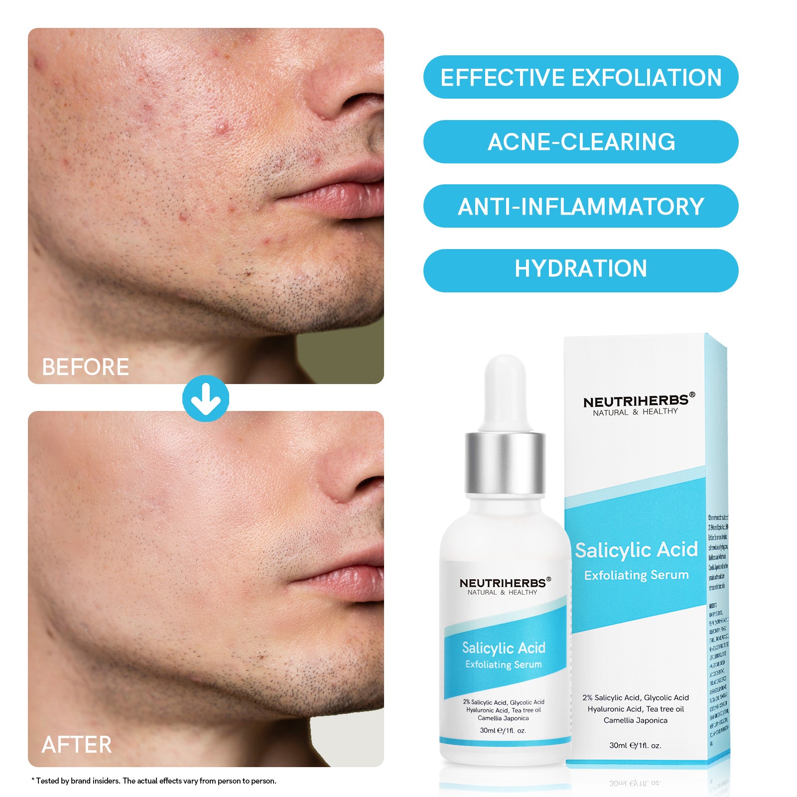 Salicylic Acid Exfoliating Serum: Ideal for oily/acne-prone skin, it gently exfoliates, prevents acne, soothes irritation, and deeply hydrates, restoring skin comfort and health.