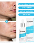 Salicylic Acid Exfoliating Serum: Ideal for oily/acne-prone skin, it gently exfoliates, prevents acne, soothes irritation, and deeply hydrates, restoring skin comfort and health.