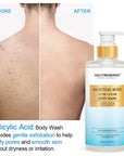 Acne Clear Salicylic Acid Body Wash