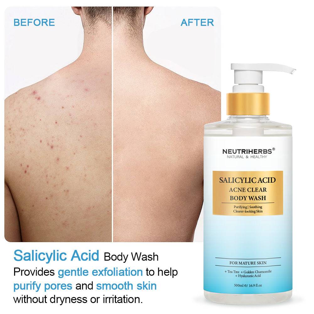 Acne Clear Salicylic Acid Body Wash