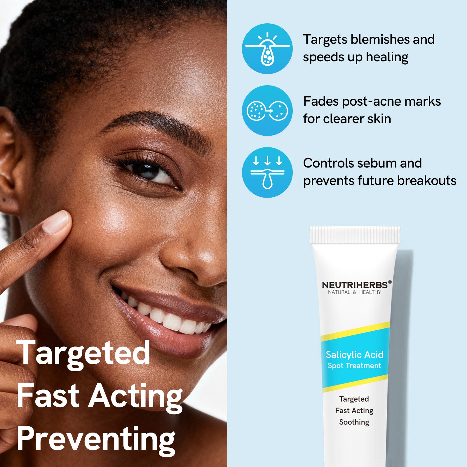 Salicylic Acid Spot Treatment for Acne &amp; Blemishes