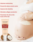 Body Stretch Mark Cream For A Smoother and Resilient Skin