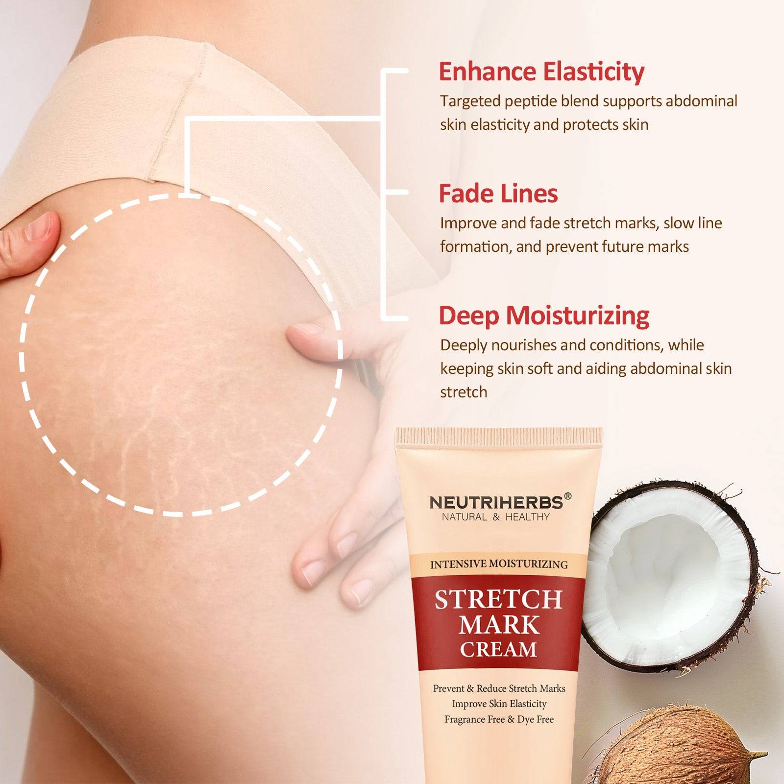 Body Stretch Mark Cream For A Smoother and Resilient Skin