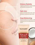 Body Stretch Mark Cream For A Smoother and Resilient Skin