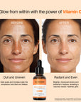 Summer Glow Trio | SPF Sunscreen + Vitamin C Glow Set