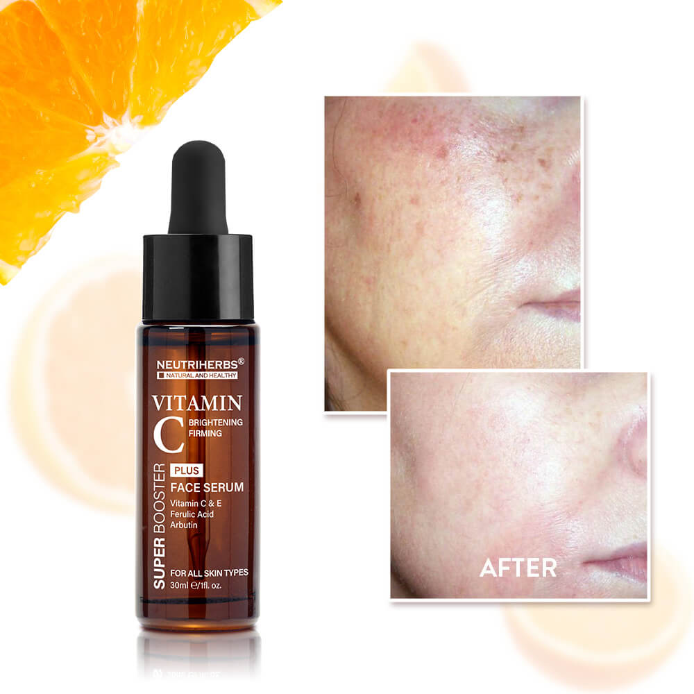Before and after vitamin c plus serum