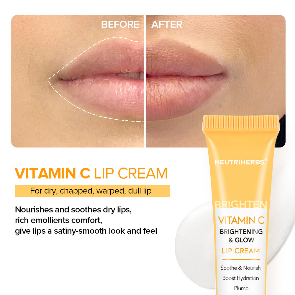 Smooth Lips: Singapore's Topical Treatments for Lip Wrinkles