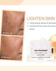 best skin lightening cream for hyperpigmentation