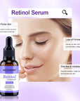 retinol serum for acne prone skin