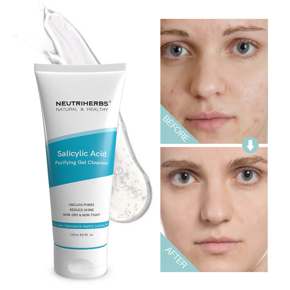 Salicylic Acid Cleanser-before and after use