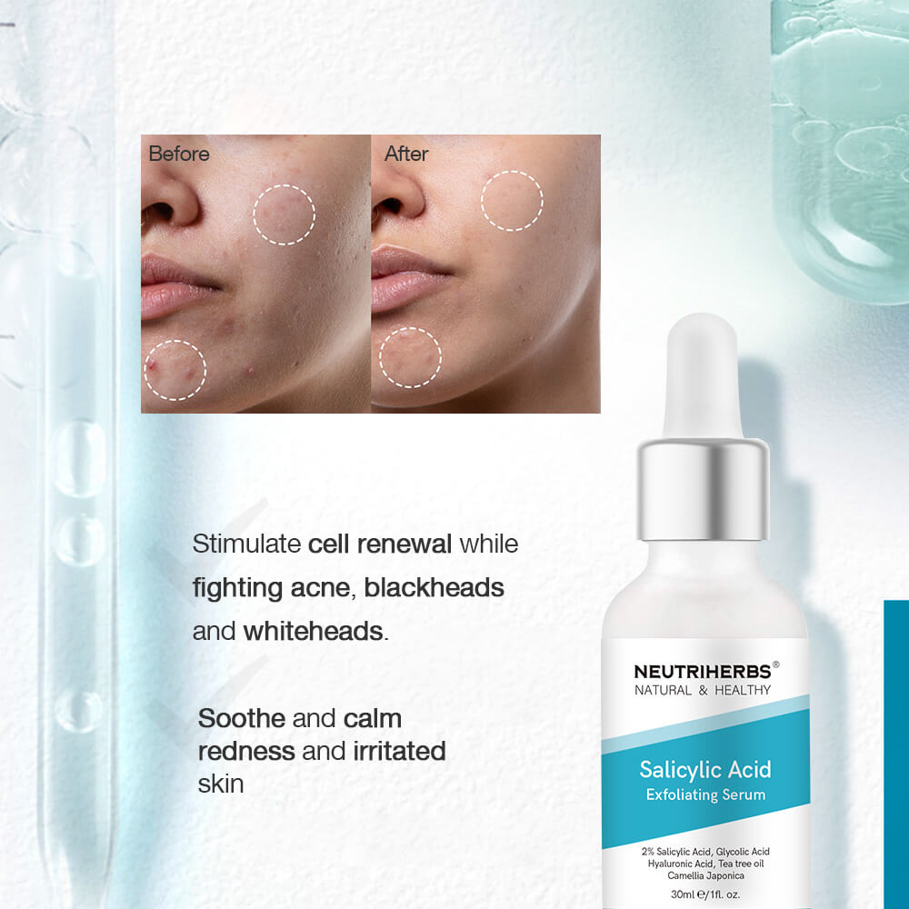 Neutriherbs salicylic acid serum for acne-prone skin