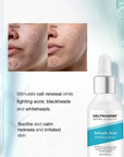 Neutriherbs salicylic acid serum for acne-prone skin